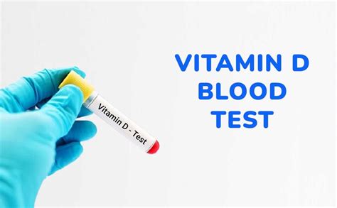 vitamin d blood test bottle colour|vitamin d reading blood test.